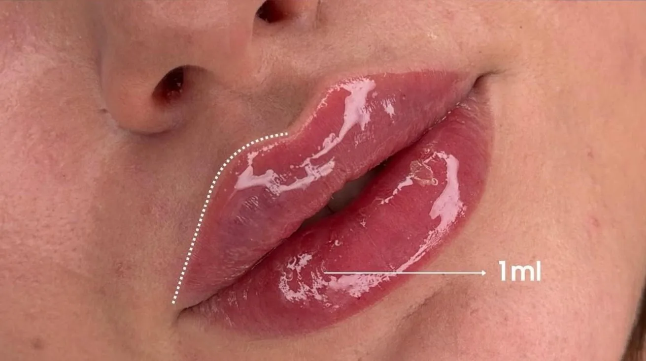 Après Traitement Lèvres Milli Face (1ml)