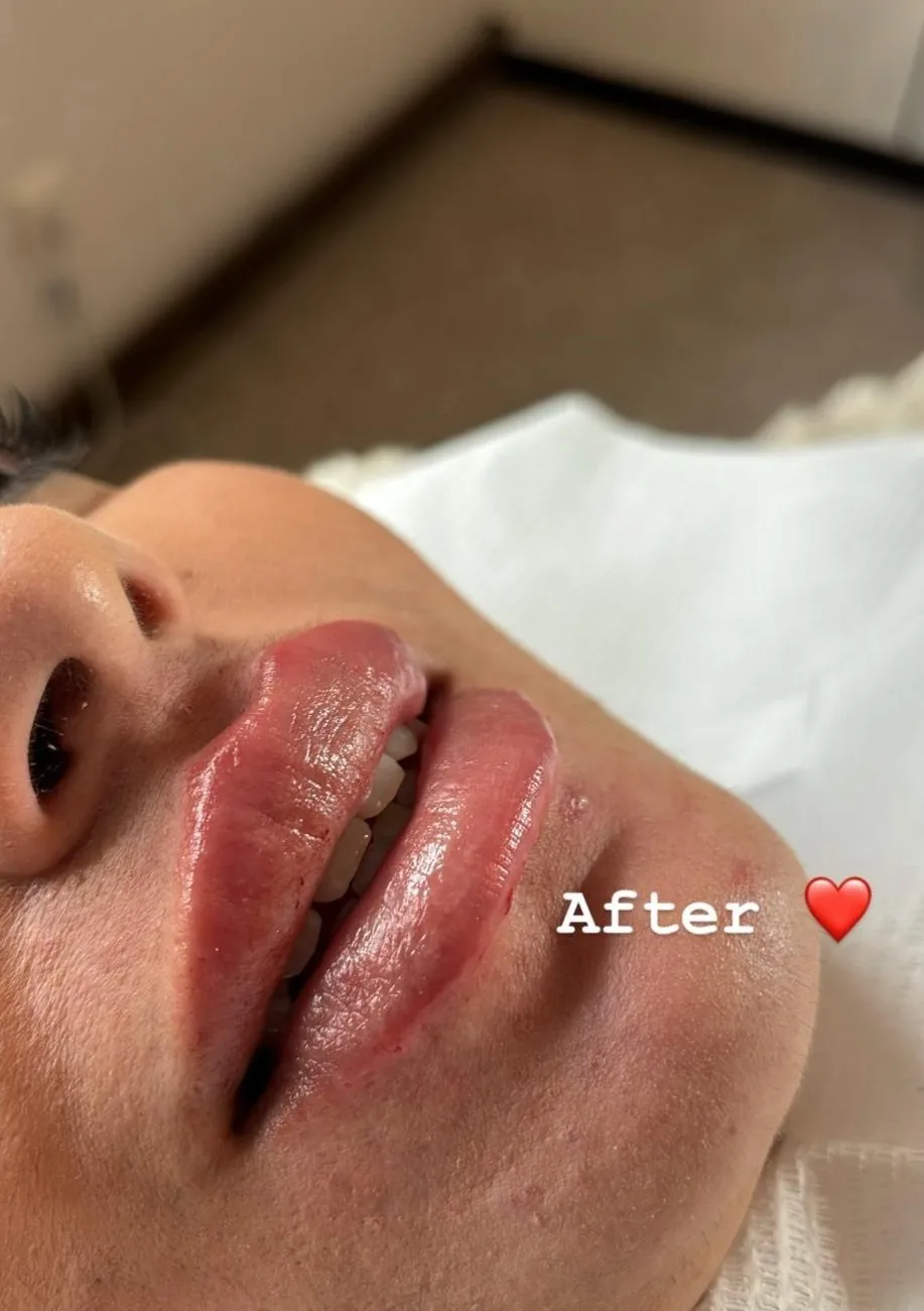 Résultat Russian Lips Profil Plat Bruxelles
