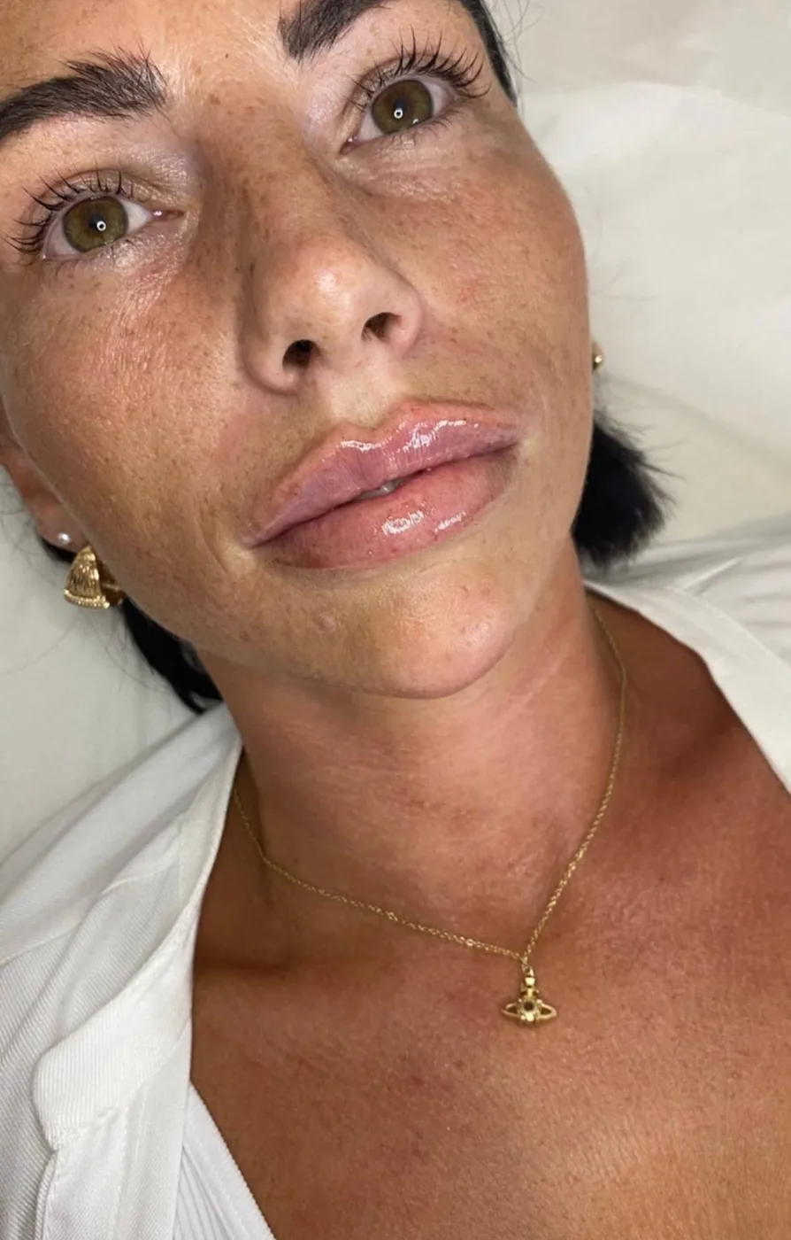 Résultat Russian Lips Visage Éclatant
